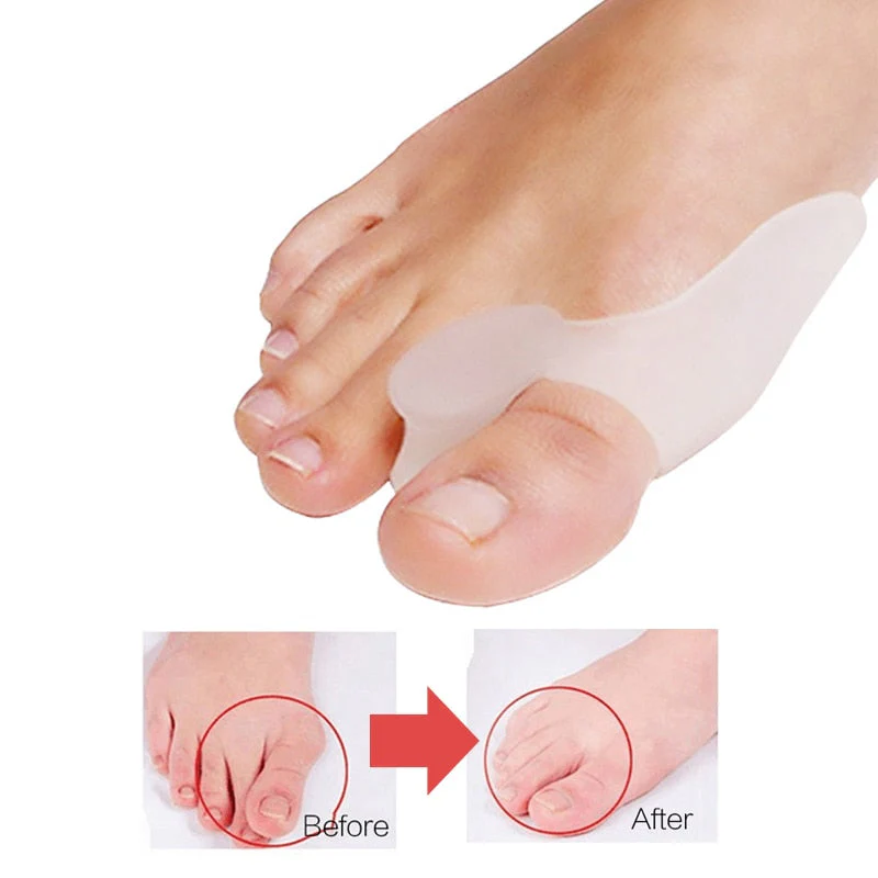 1 Pair (2Pcs) Toe Orthopedic Silicone Pad - Image 22