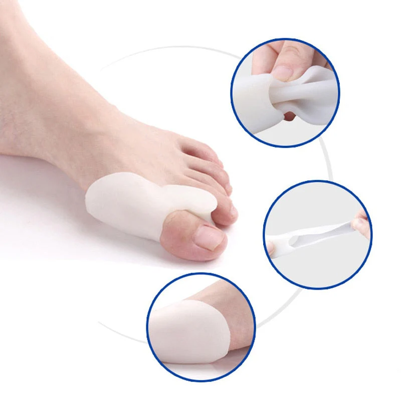 1 Pair (2Pcs) Toe Orthopedic Silicone Pad - Image 6