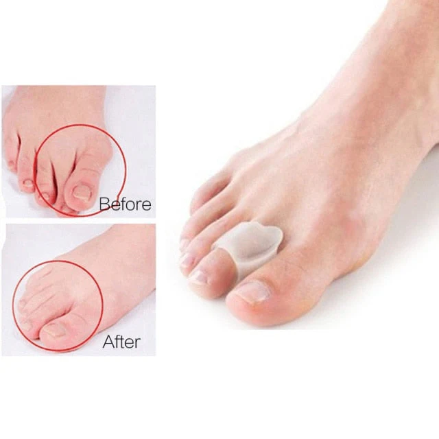 1 Pair (2Pcs) Toe Orthopedic Silicone Pad - Image 8