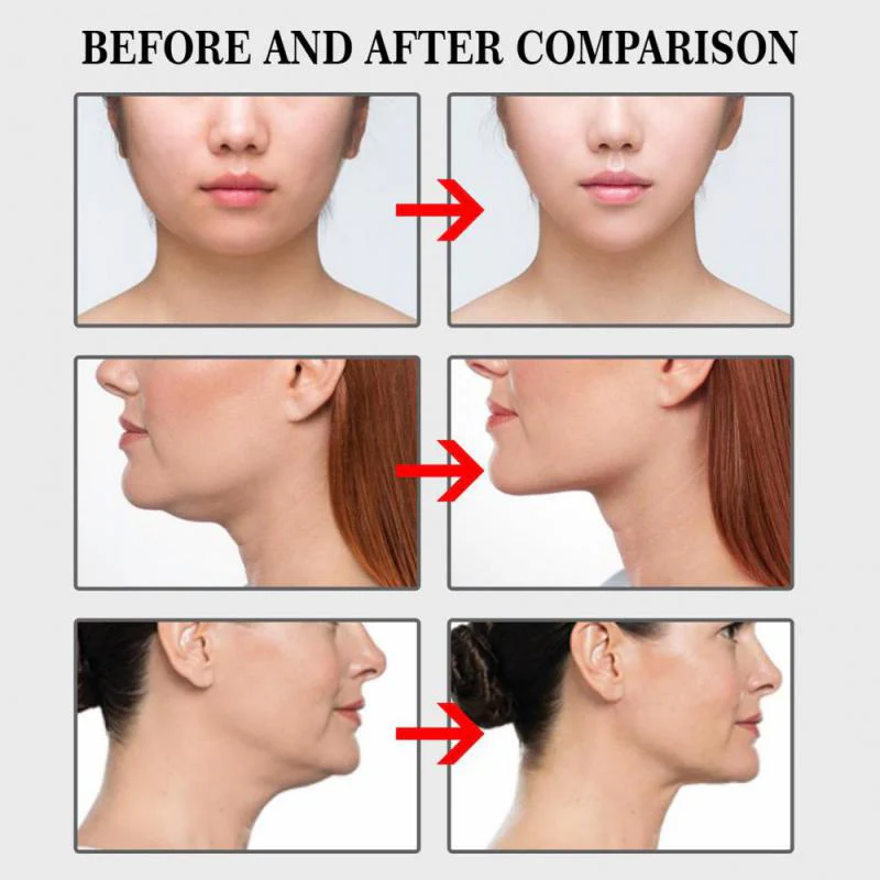 100PCS Invisible Face Lift Stickers - Image 5