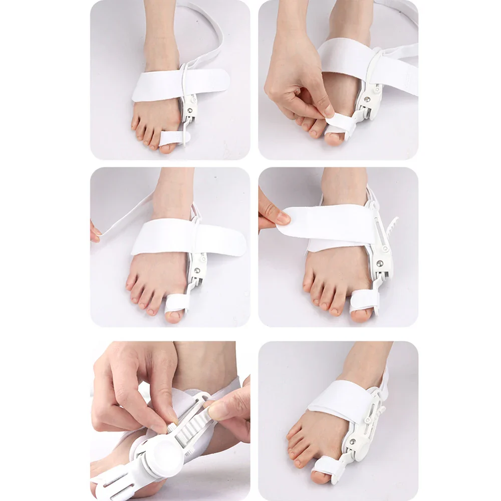 1PC Orthopedic Toe Bunion Corrector - Image 18