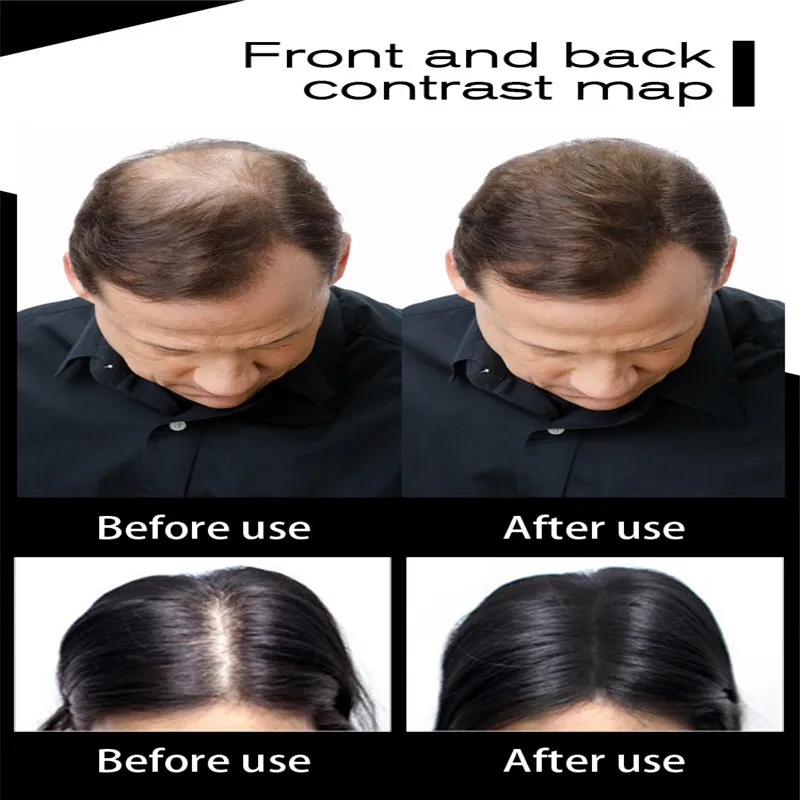 27.5g Hair Fiber Keratin Thickening Spray - Image 4