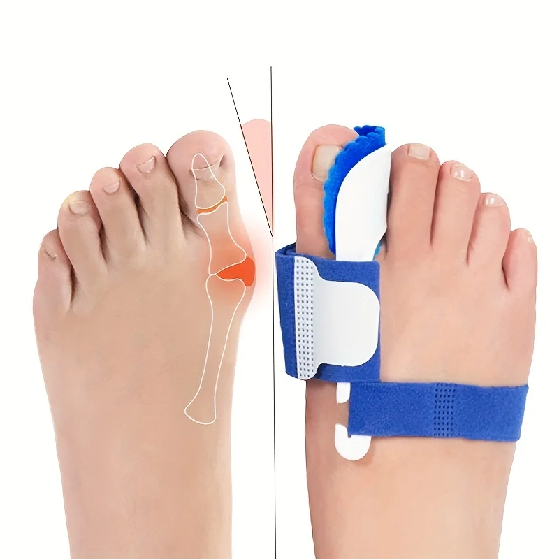 2PCS Orthopedic Toe Corrector - Image 13