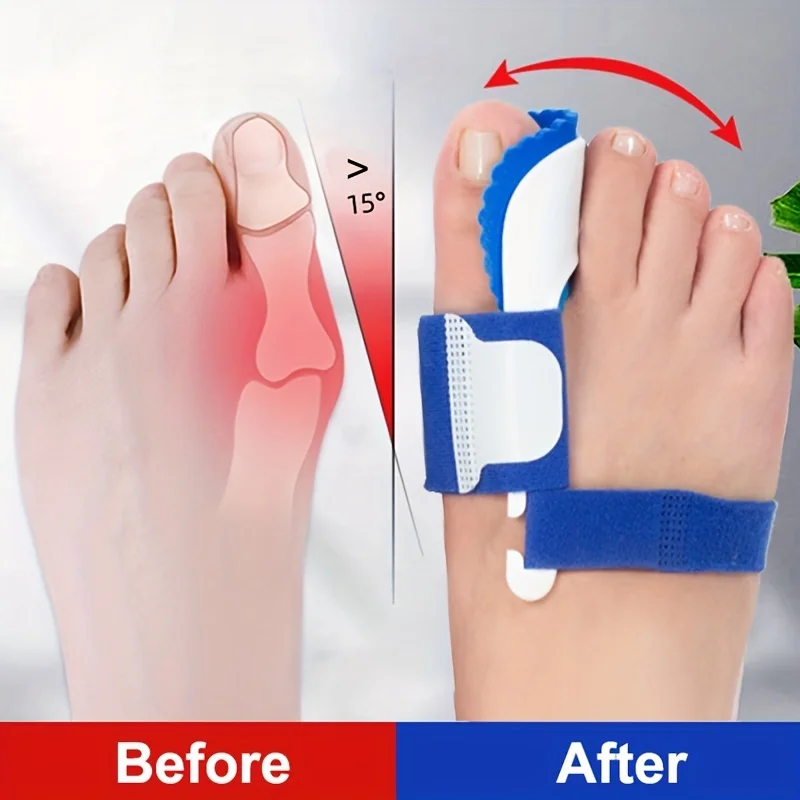 2PCS Orthopedic Toe Corrector - Image 7
