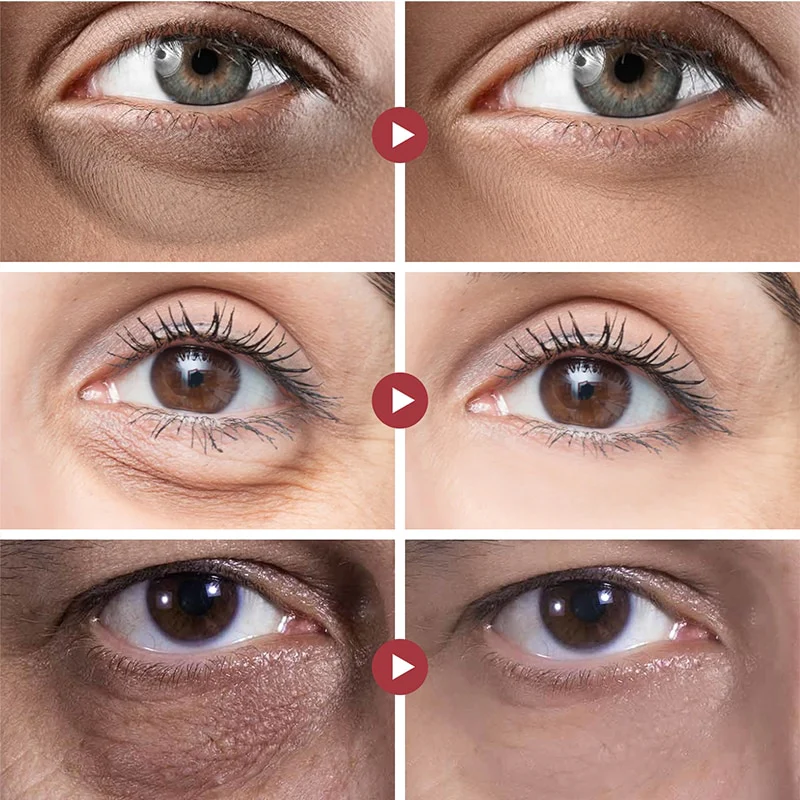 Anti Dark Circle Peptide Eye Cream - Image 2