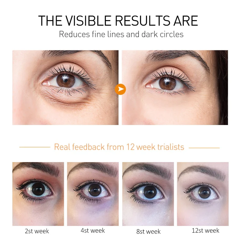 Anti Dark Circle Peptide Eye Cream - Image 5