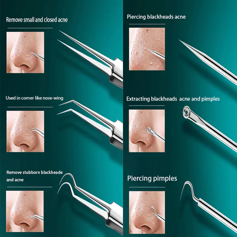 Blackhead Acne Remover Tool Kit - Image 21