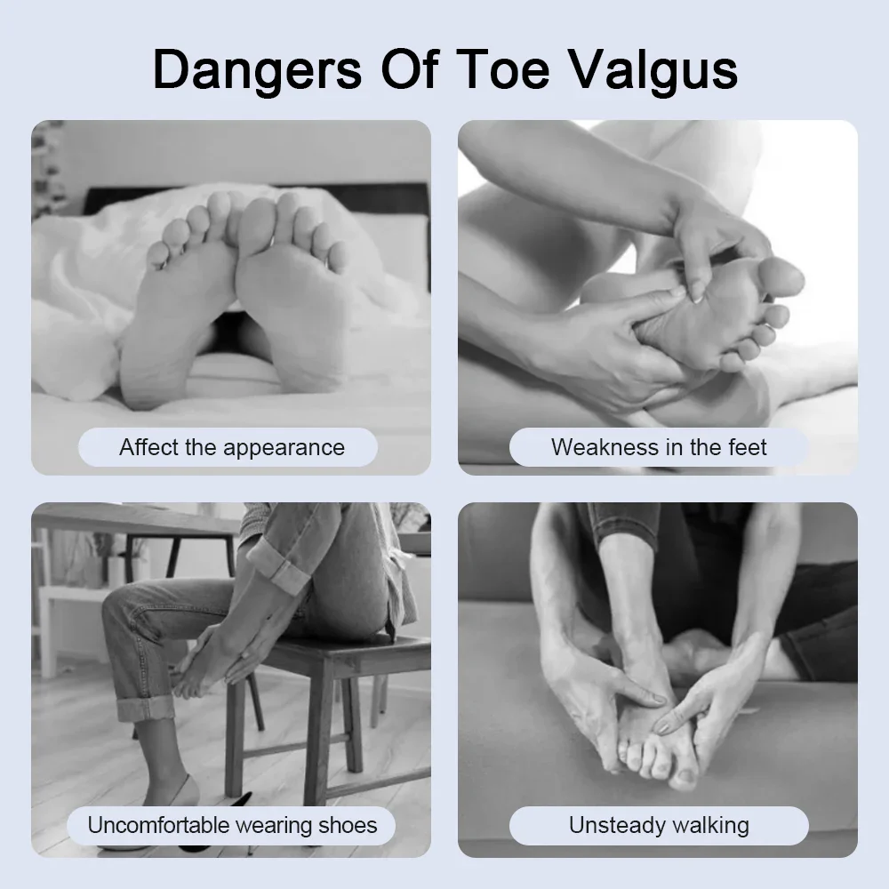 Bunion Toe Orthopedic Corrector - Image 8