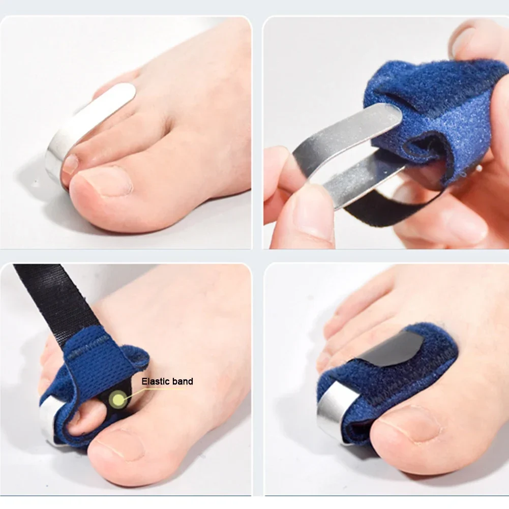 Crooked Toe Straightener - Image 3