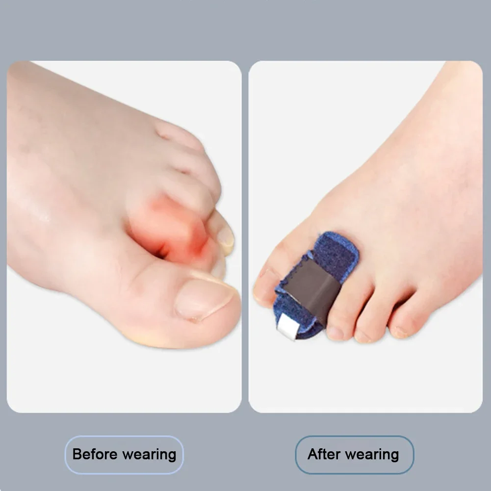 Crooked Toe Straightener - Image 5