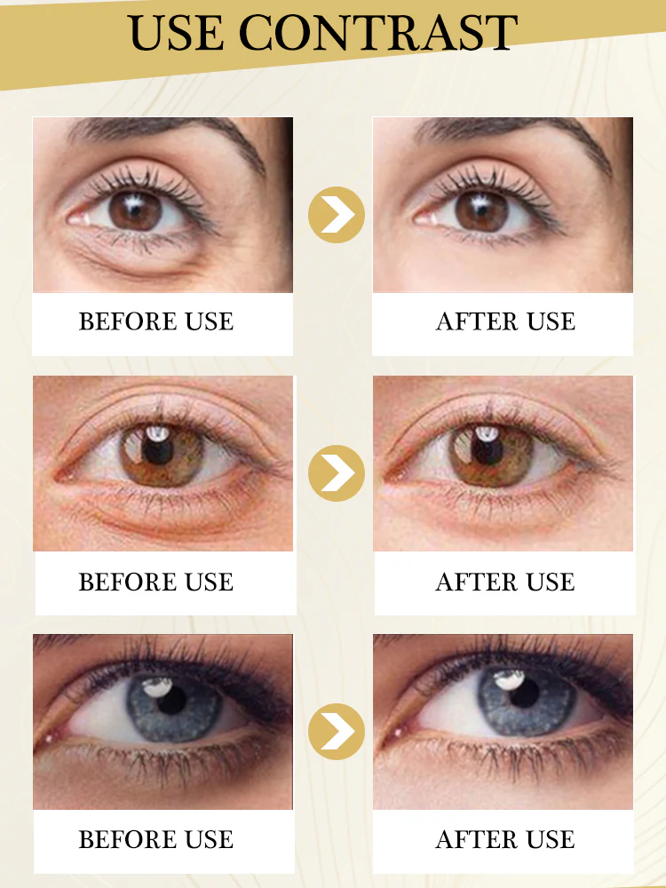 Eye Bags Wrinkle Removal Eye Cream - Image 13