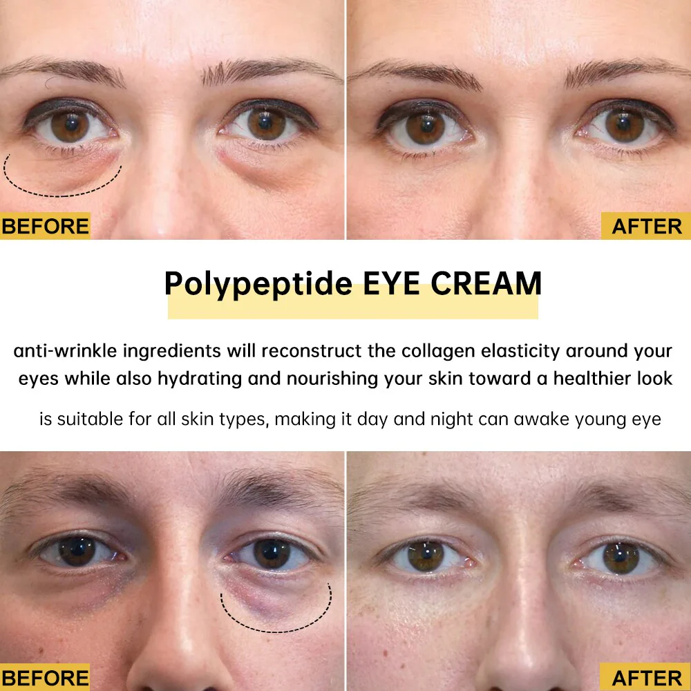 Eye Bags Wrinkle Removal Eye Cream - Image 2