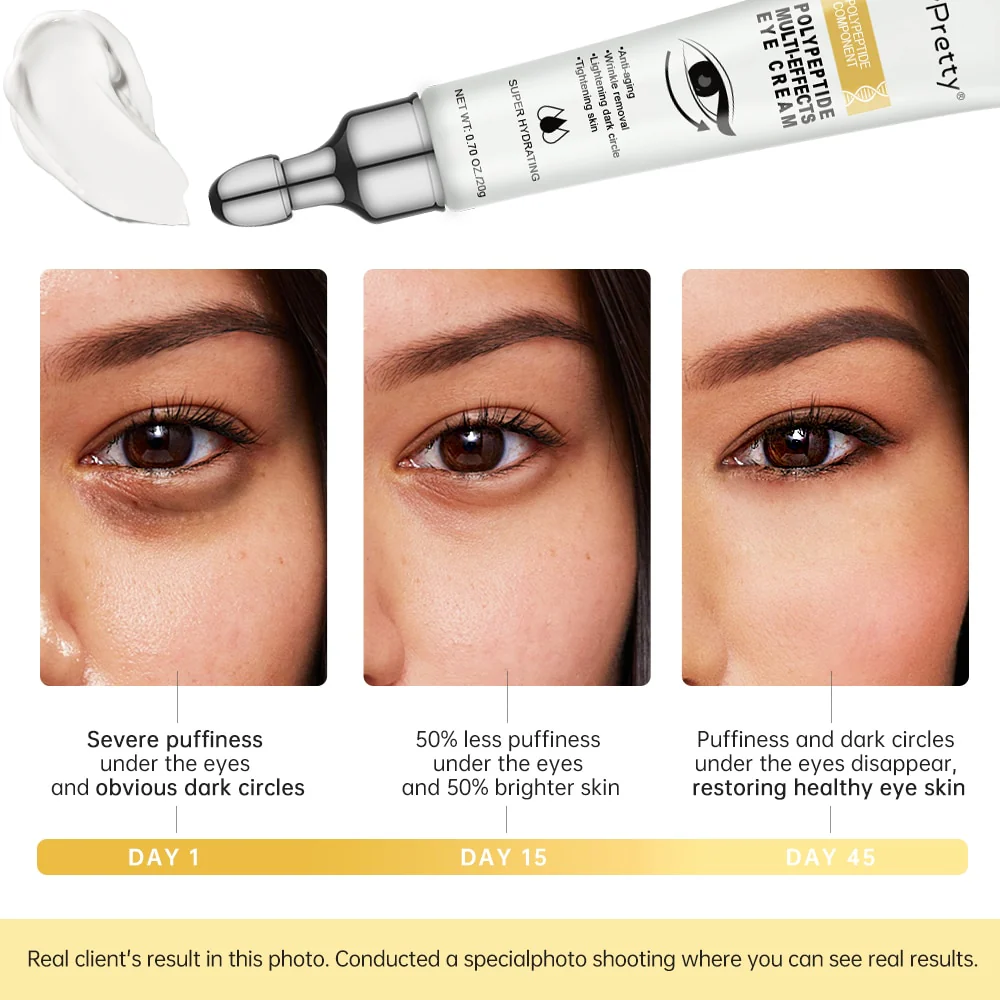 Eye Bags Wrinkle Removal Eye Cream - Image 4