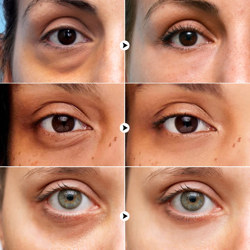 Eye Bags Wrinkle Removal Eye Cream - Image 6