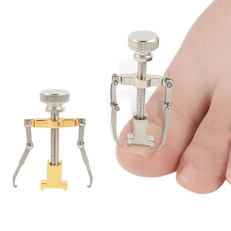Ingrown Toenails Correcter - Image 4