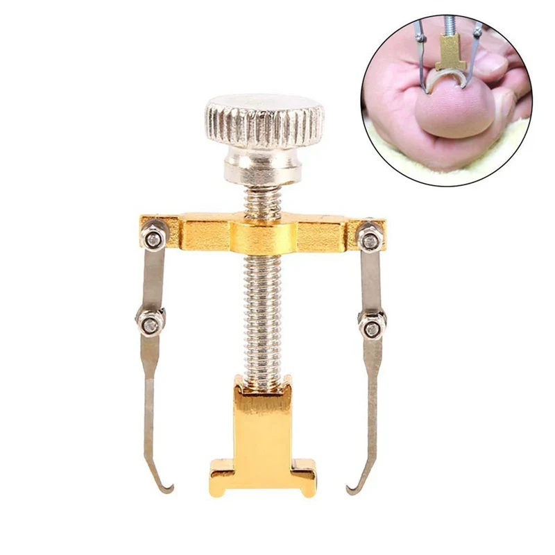 Ingrown Toenails Correcter - Image 5