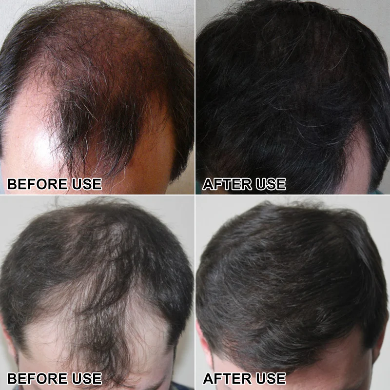 Keratin Hair Fiber Spray - Image 15