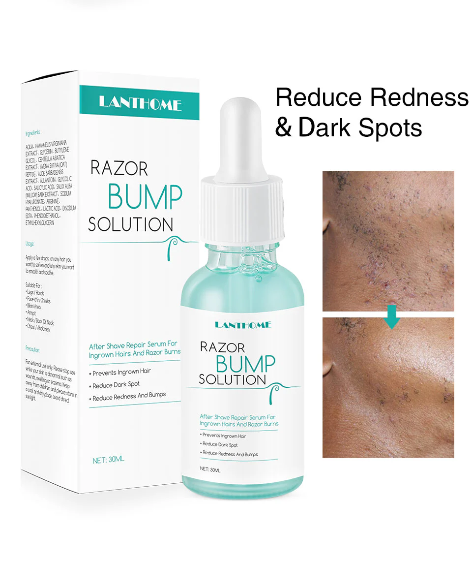 LANTHOME Razor Bump Solution for Ingrown Hair - Image 4