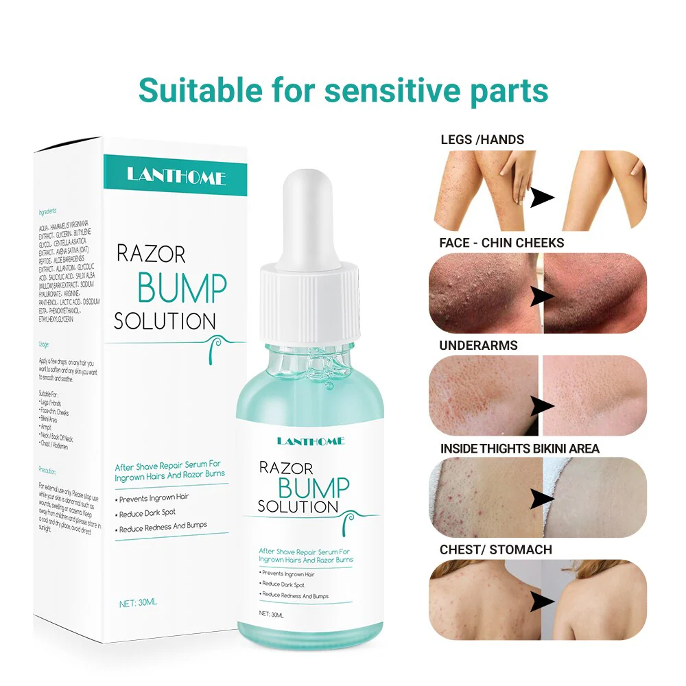 LANTHOME Razor Bump Solution for Ingrown Hair - Image 5