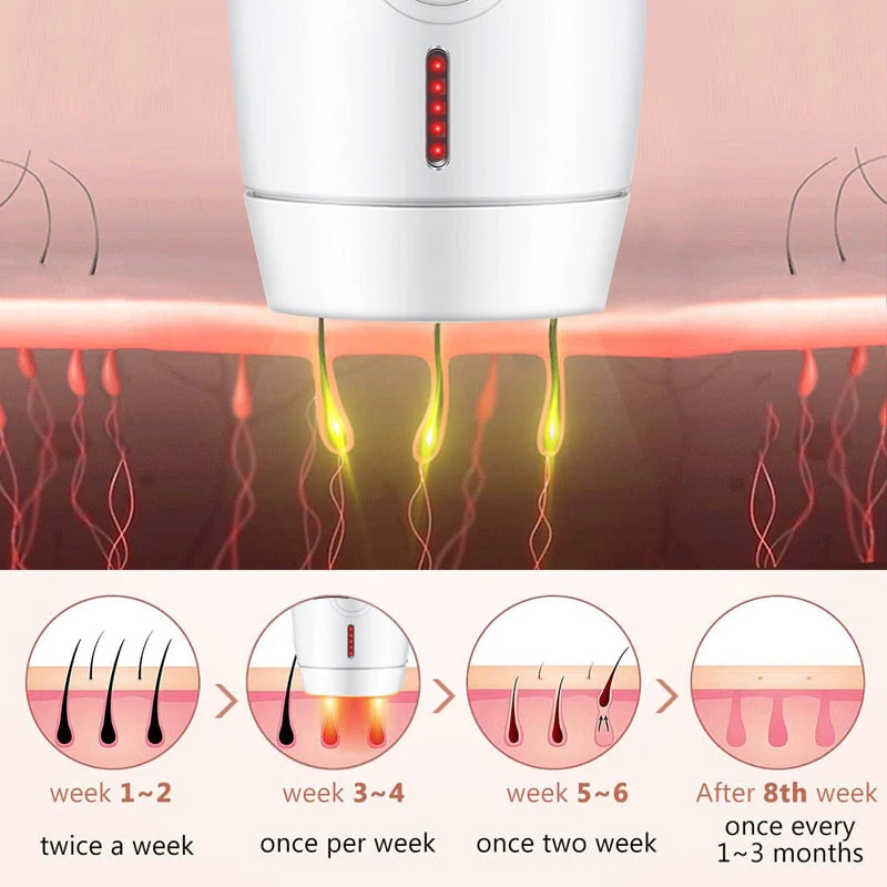 Prestige IPL Cordless Hair Removal Device - Image 5