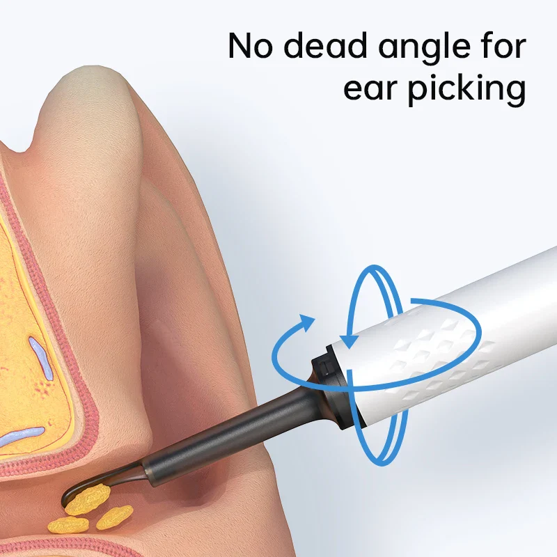 Smart Ear Cleaner - Image 3