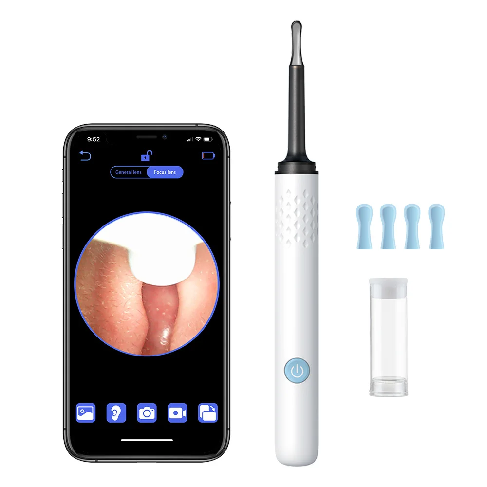 Smart Ear Cleaner - Image 7
