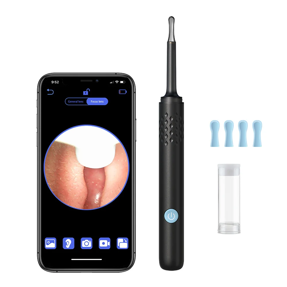 Smart Ear Cleaner - Image 8
