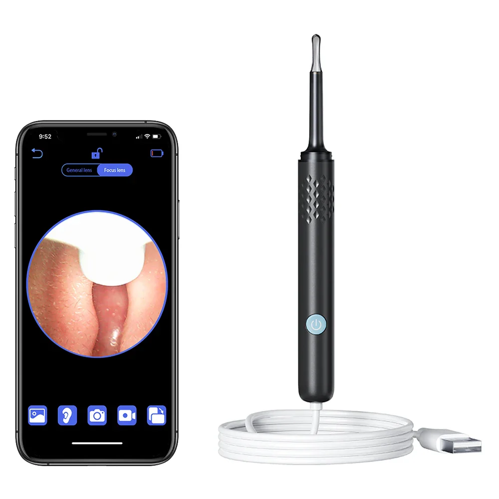 Smart Ear Cleaner - Image 9