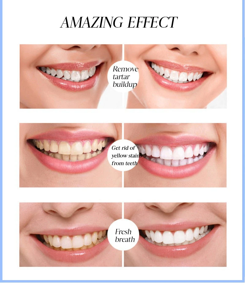 Teeth Whitening Pen - Image 3