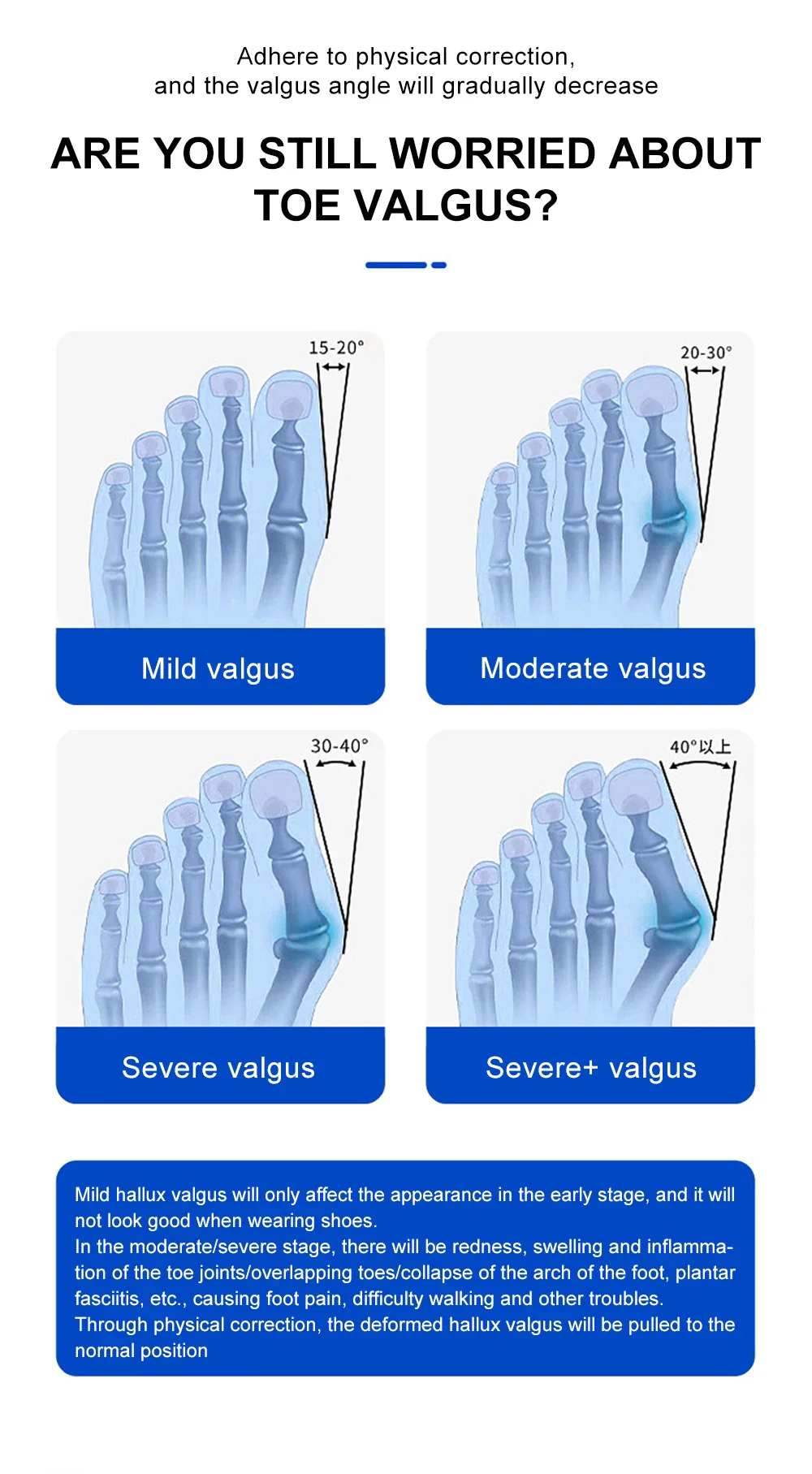 Toe Orthopedic Corrector - Image 11