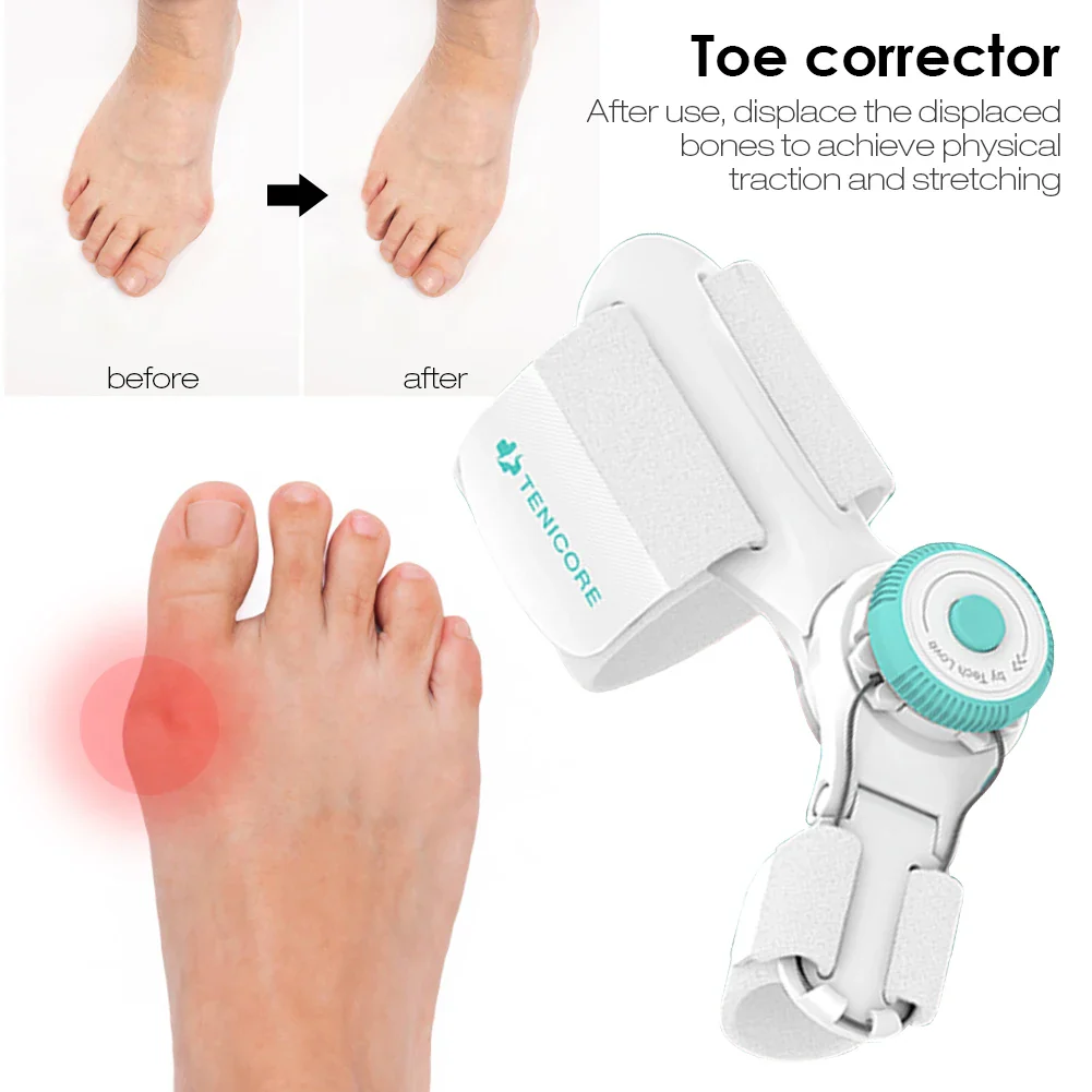 Toe Straightener Corrector - Image 16