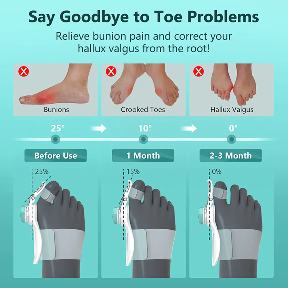 Toe Straightener Corrector - Image 4