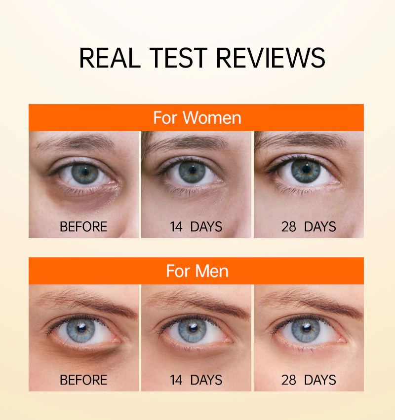 Vitamin C Anti Dark Circles Eye Cream - Image 10