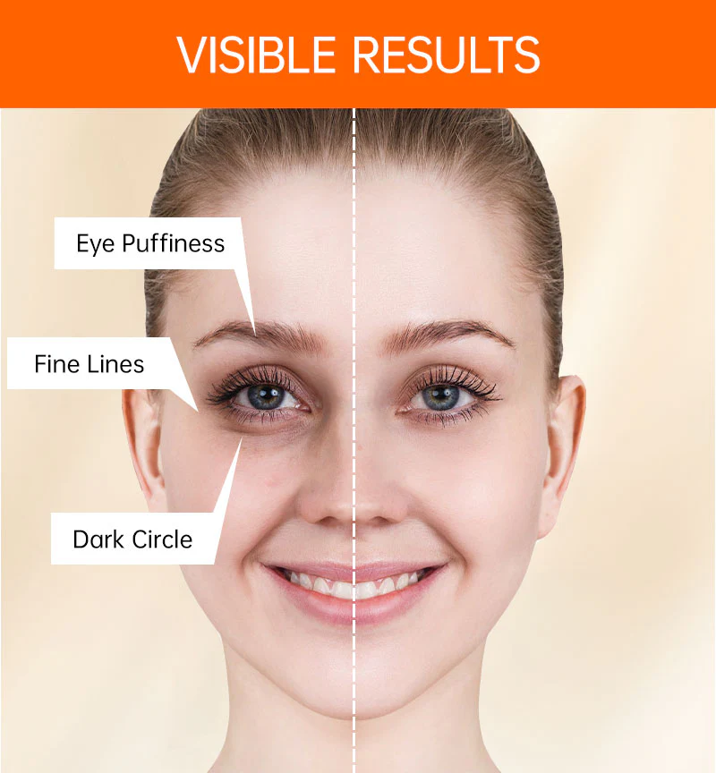 Vitamin C Anti Dark Circles Eye Cream - Image 14