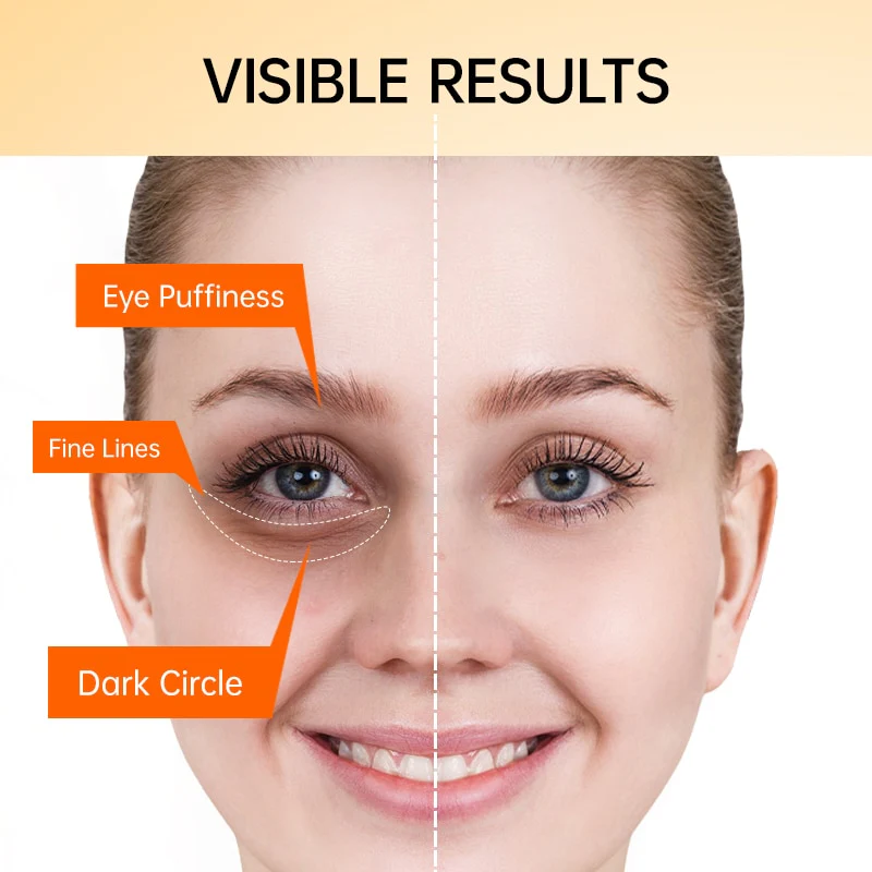 Vitamin C Anti Dark Circles Eye Cream - Image 2