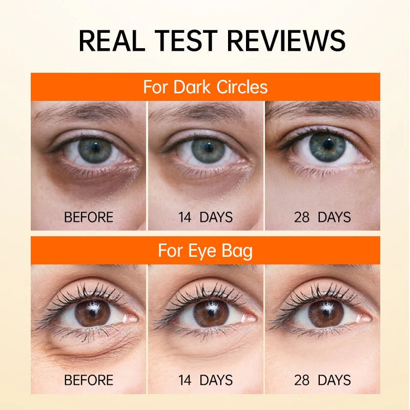 Vitamin C Anti Dark Circles Eye Cream - Image 3